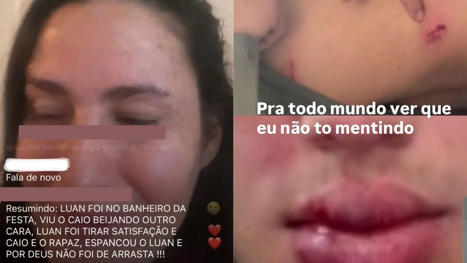 Segundo ela, a briga teria sido motivada por ciúmes, após Caio flagrar Luan beijando outro rapaz na balada.
