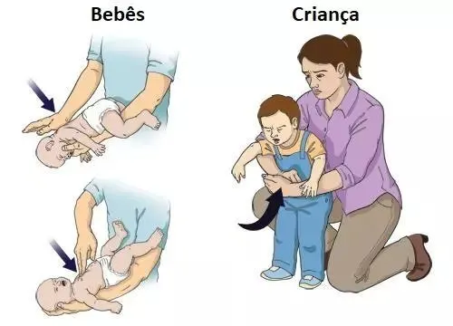 O engasgo ocorre quando o corpo tenta expelir um alimento ou objeto que segue um “caminho errado” durante a deglutição.