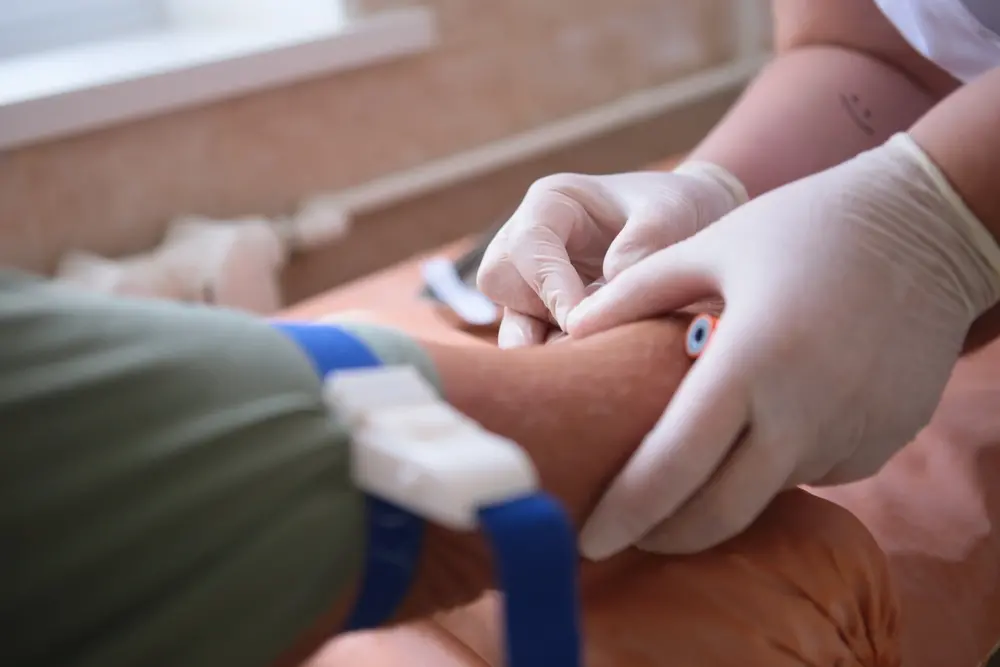 foto de paciente fazendo exame de sangue. Na imagem, a enfermeira pressiona o braço do paciente para retirar o sangue com a agulha utilizando luvas brancas.