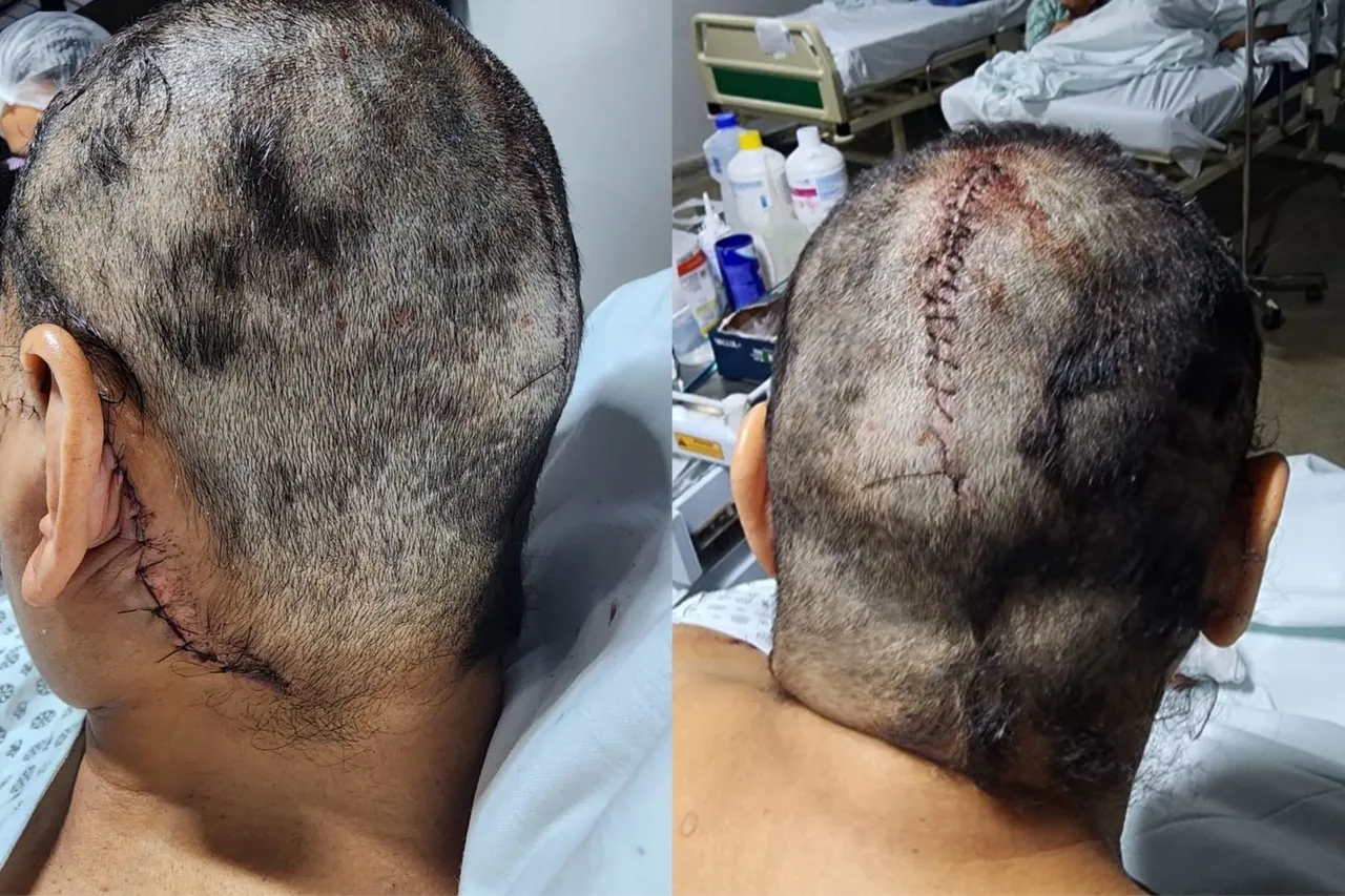 A mulher levou 283 pontos na cabeça.
