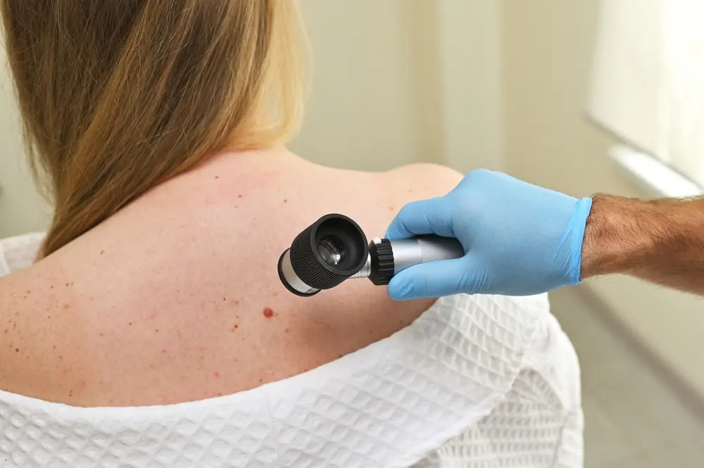 foto de paciente com pintas e manchas nas costas sendo examinada por médico com aparelho de dermatoscopia.